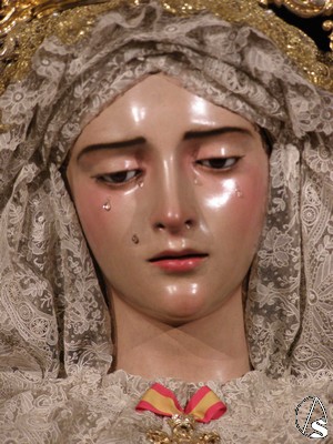 Restauraciones en San Roque