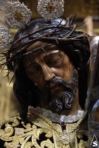 misericordia siete alberto