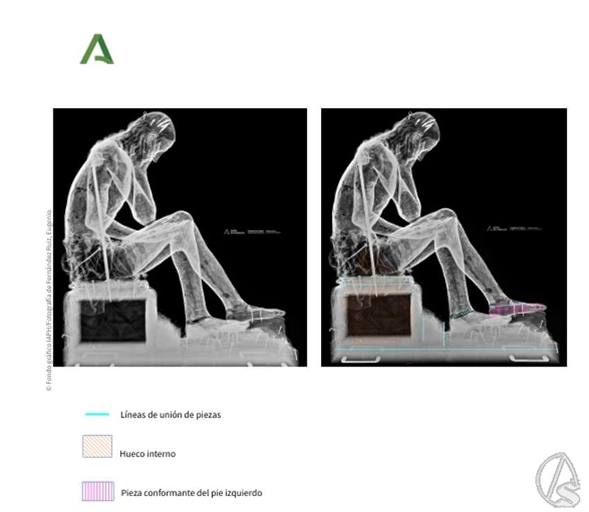 radiografia-CH-y-P-1