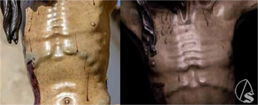torso